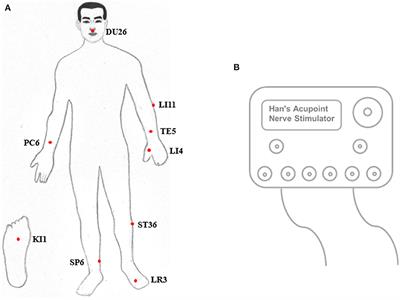 Outcome Prediction in Unresponsive Wakefulness Syndrome and Minimally Conscious State by Non-linear Dynamic Analysis of the EEG